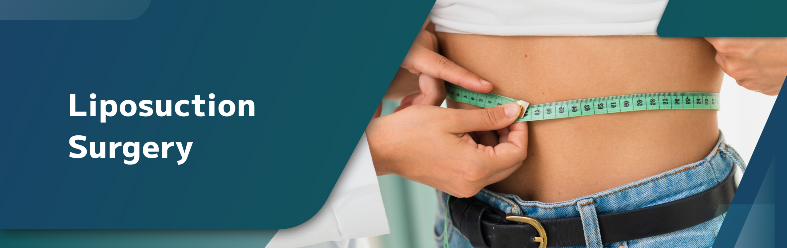 Liposuction Surgery in Janakpuri