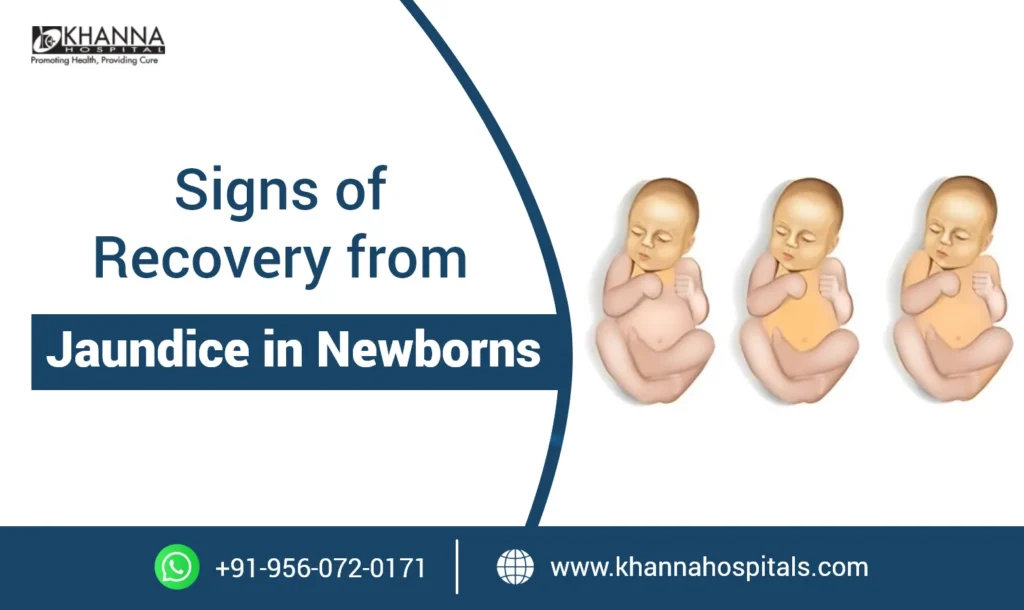 Signs of Recovery from Jaundice in Newborns