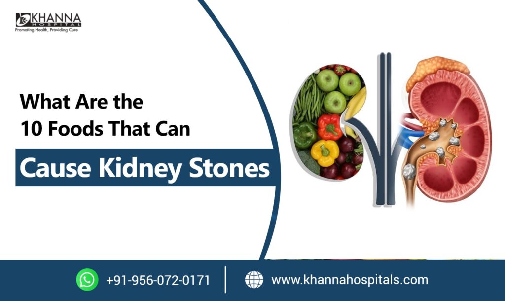 What Are the 10 Foods That Can Cause Kidney Stones