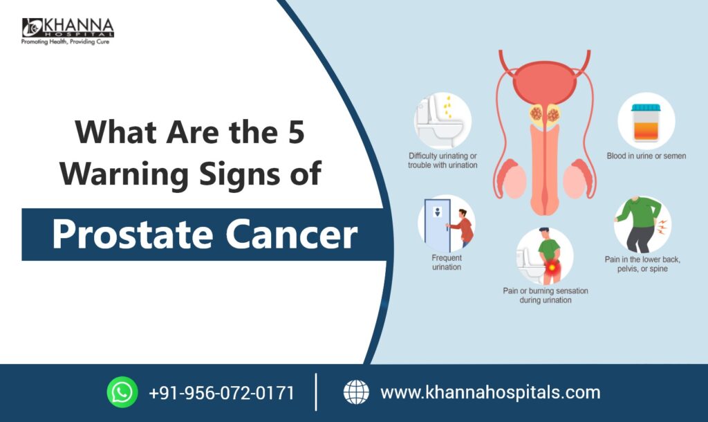 What Are the 5 Warning Signs of Prostate Cancer