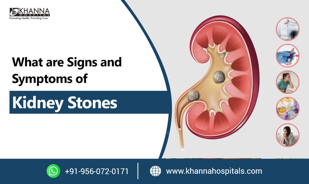 What are Signs and Symptoms of Kidney Stones?