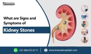 What are Signs and Symptoms of Kidney Stones?