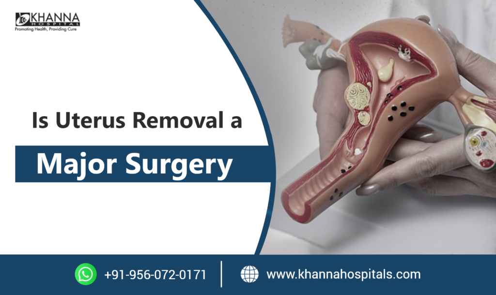 Is Uterus Removal a Major Surgery
