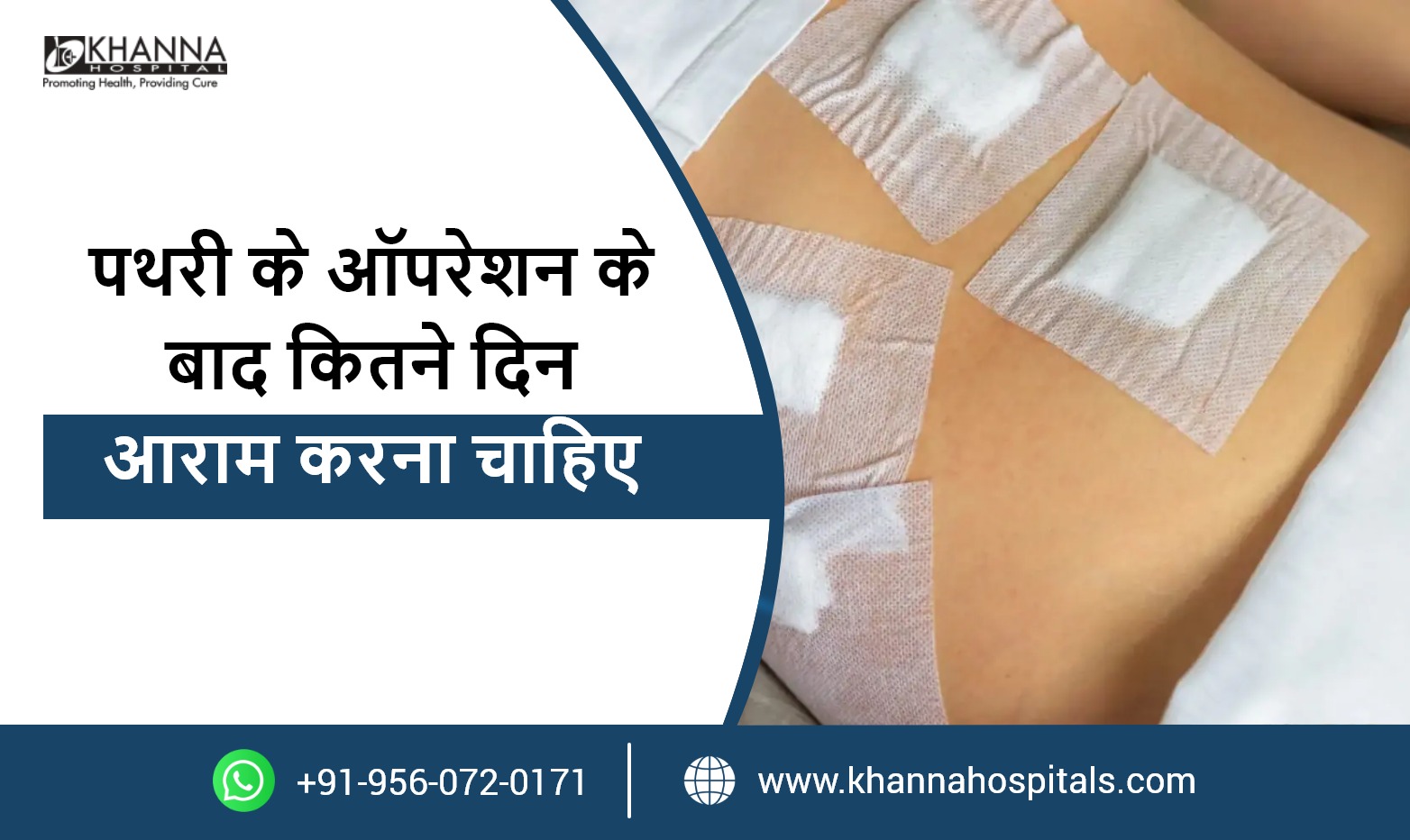 पथरी के ऑपरेशन के बाद कितने दिन आराम करना चाहिए