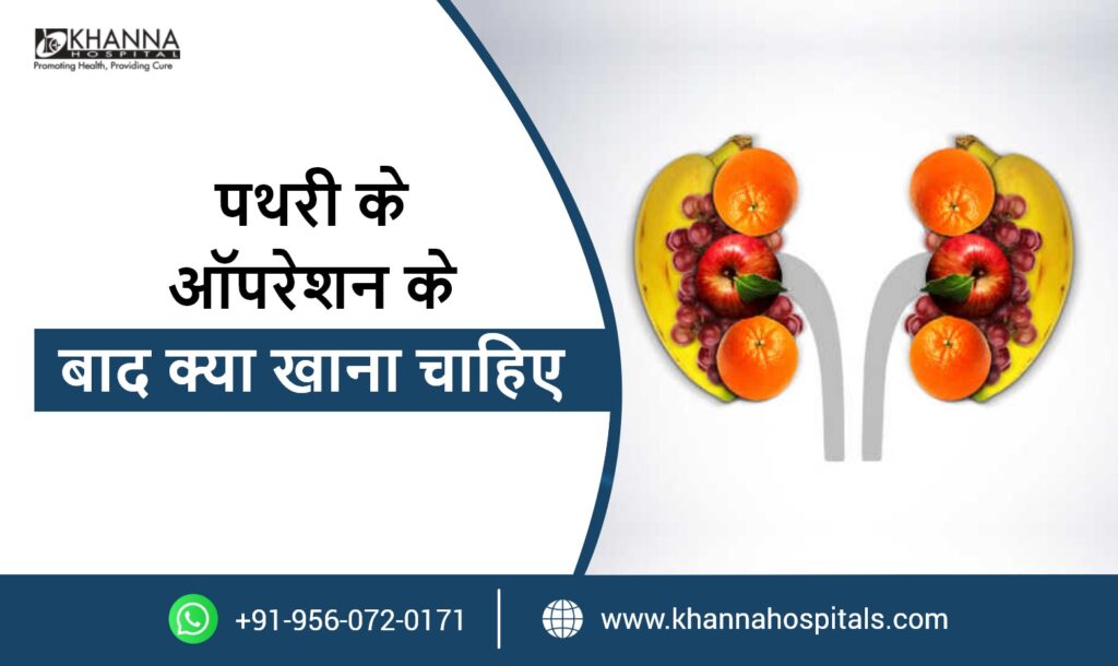 पथरी के ऑपरेशन के बाद क्या खाना चाहिए