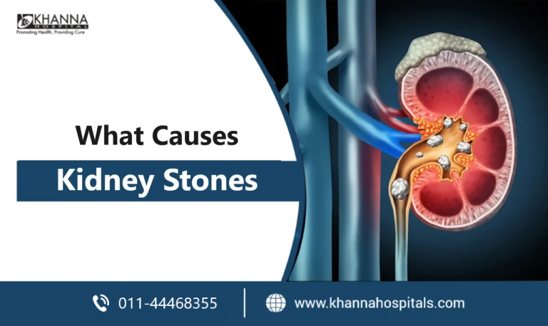What Causes Kidney Stones? Common Causes, Risk & Prevention